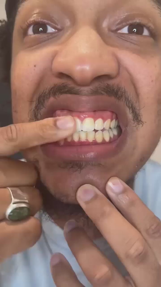 blanqueador dental